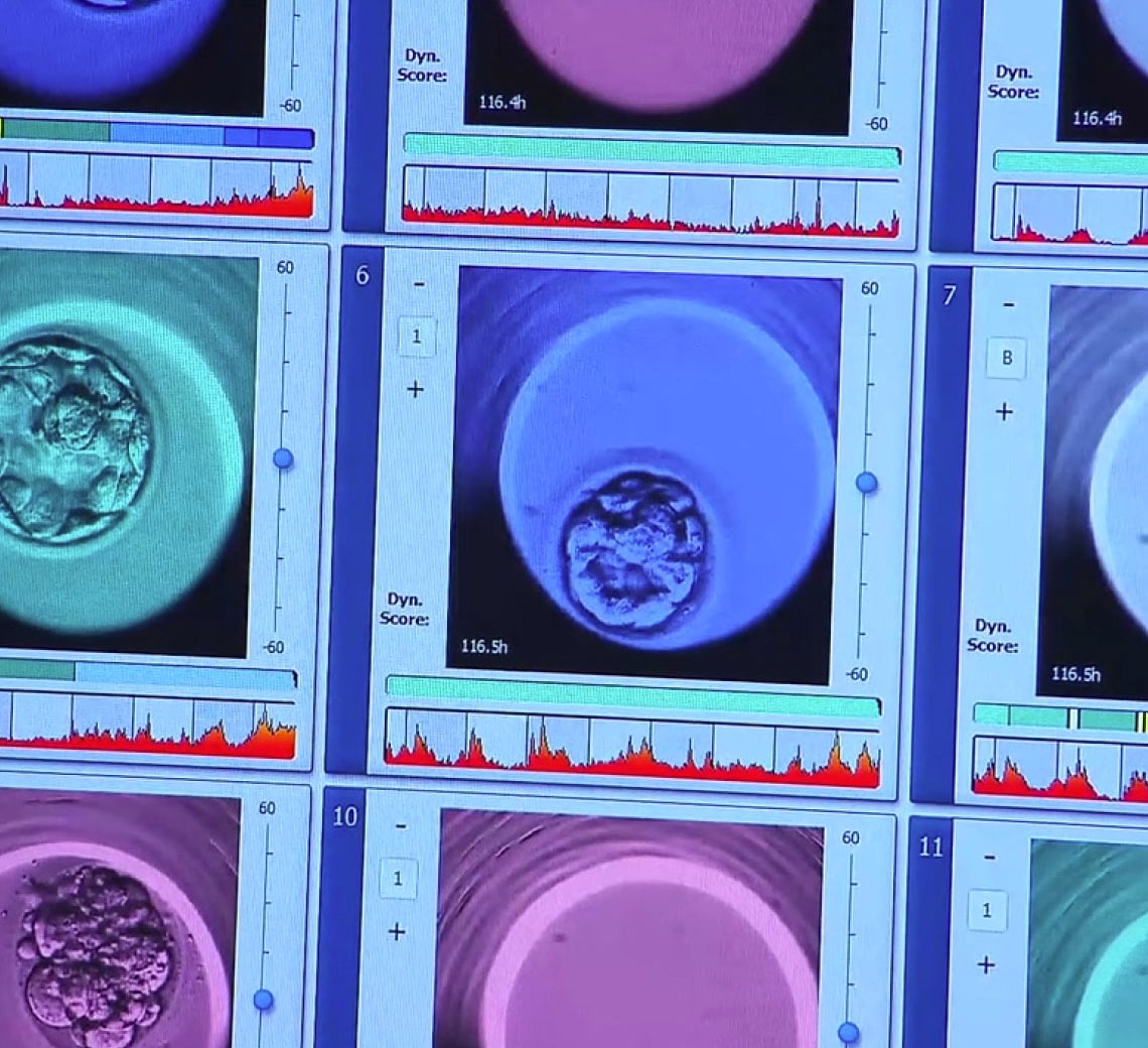 A photograph of a screen with photographs of stages of development of an embryo.
