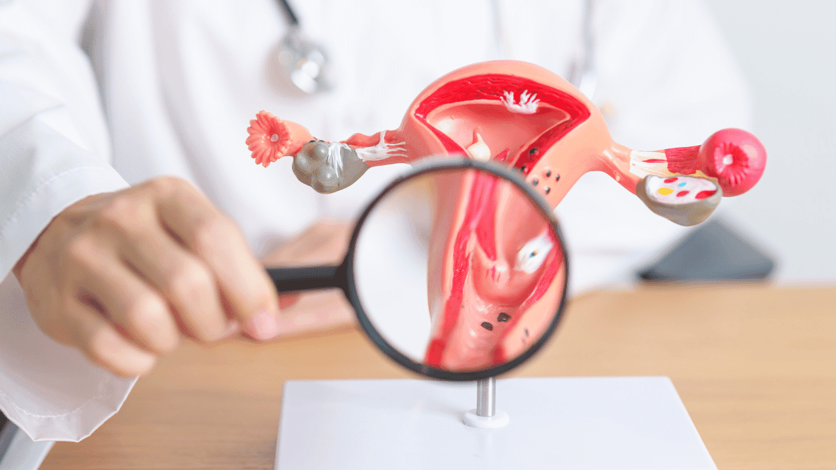 Doctor holding a magnifying glass up to a uterus model.