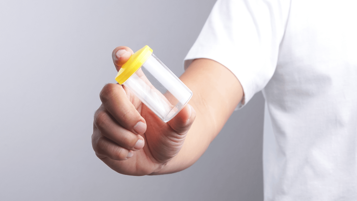 A hand of a person wearing a white shirt holding out an empty container to collect sperm.