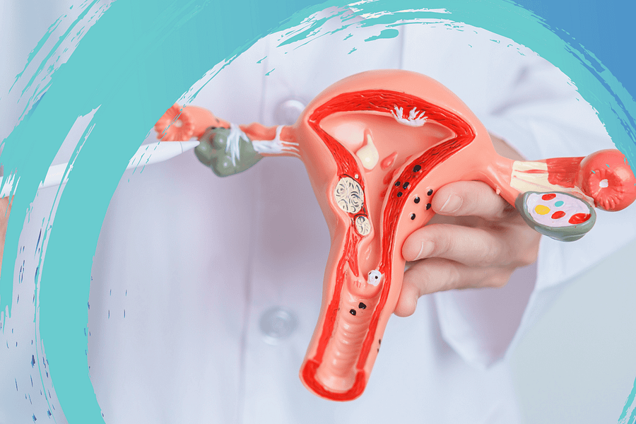 Plastic model of a uterus and ovaries with an EVOLVE swirl in background